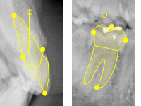 Teeth symbols